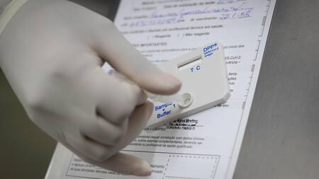 Prueba de COVID-19. Foto: EFE