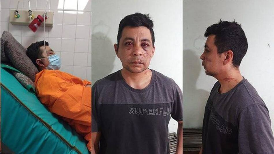 Daniel Porro, enfermero golpeado por sus vecinos por tener coronavirus