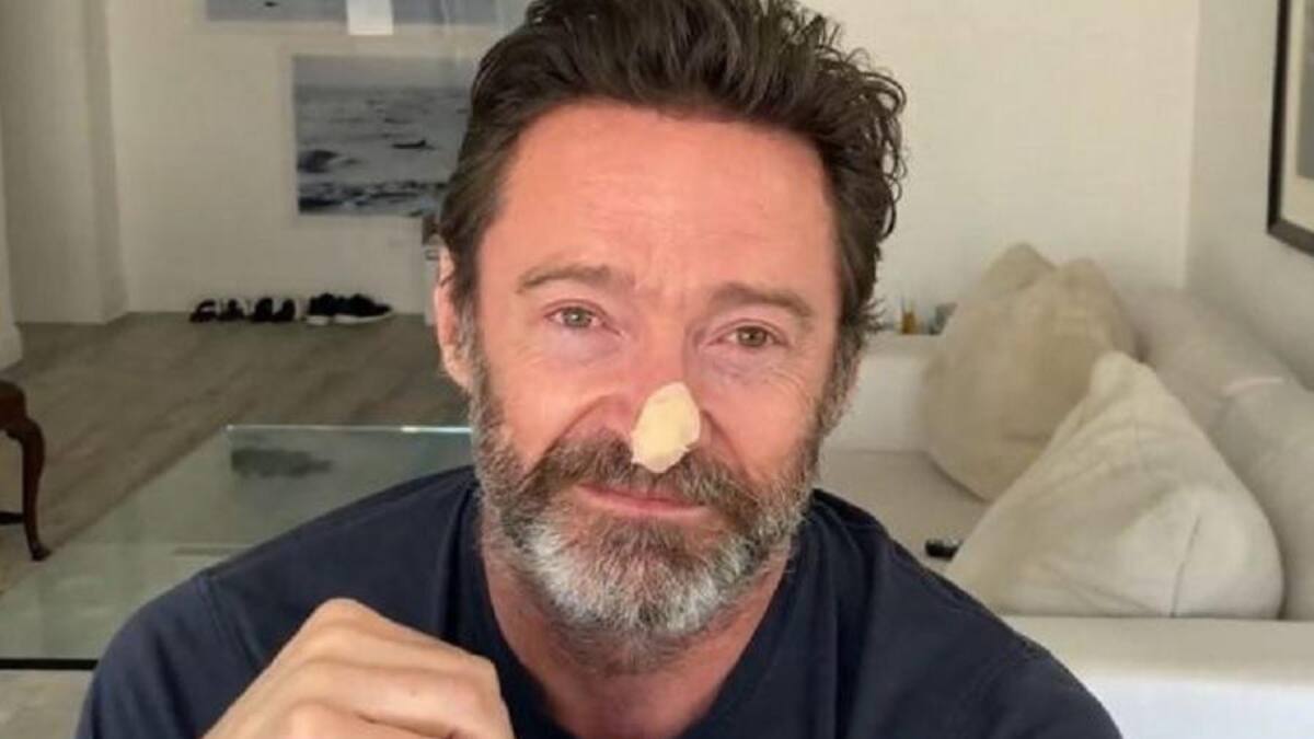 Hugh Jackman mostró su estado en redes sociales.