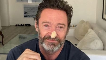 Hugh Jackman, nuevamente con riesgo de cáncer de piel: “Por favor, usen protector solar”