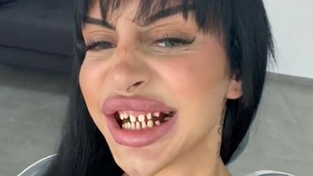 Se arregló los dientes. Foto: captura.