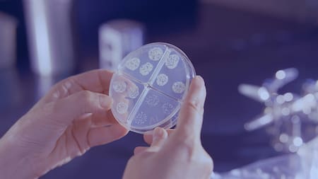 Bacterias. Foto: Unsplash