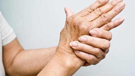 Artritis. Foto: NA.