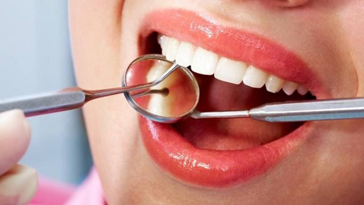 Limpieza bucal - salud