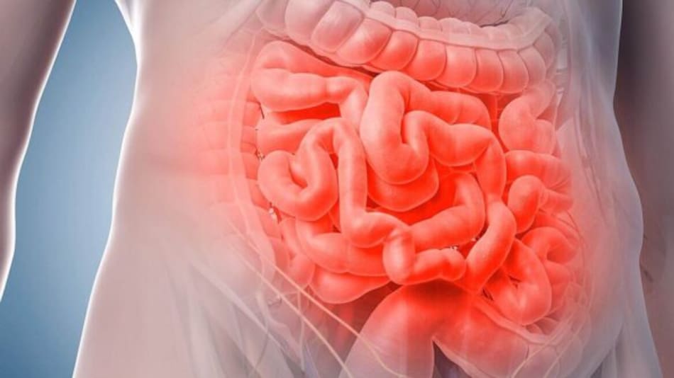 Íleo postoperatorio