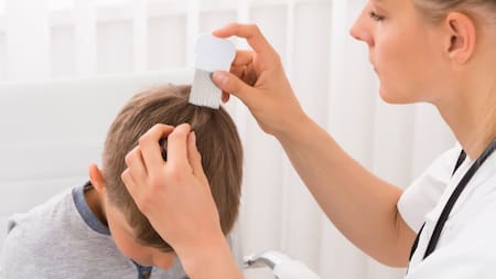 Pediculosis. Foto: X