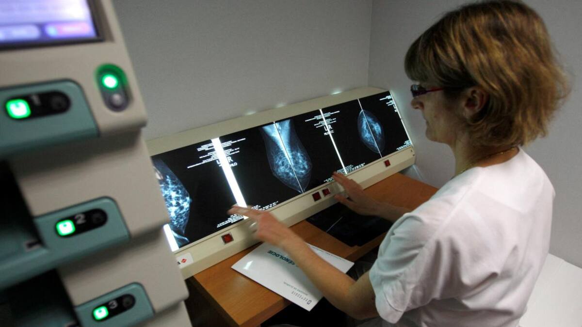 Exámenes de mamografía. Foto: Reuters