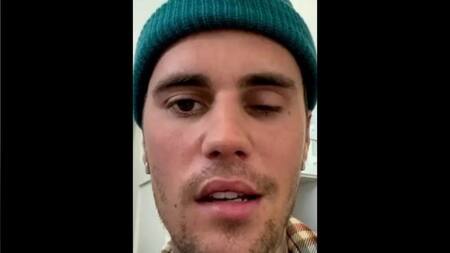 Síndrome de Ramsay Hunt: de qué se trata la enfermedad que padece Justin Bieber