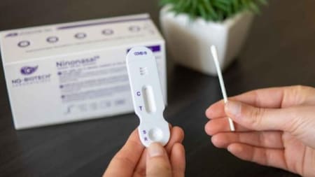 Autotest, coronavirus en Argentina, foto NA