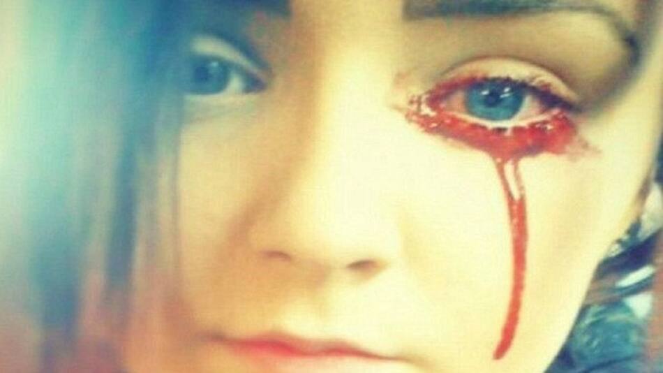 Adolescente llora sangre