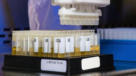 Orina. Foto: Unsplash.