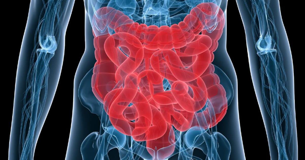 Eca Colon Cáncer de colon: más de 11 mil personas detectaron a través de una app ...