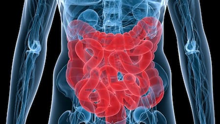 Cáncer de colon, foto IBBiotech