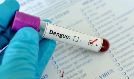 Dengue, análisis en laboratorio, estudios