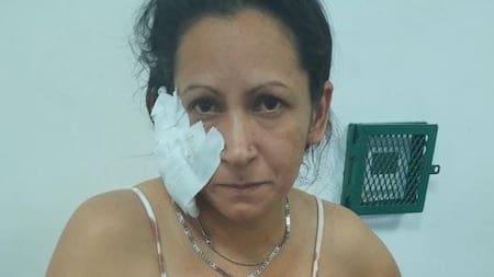 Pamela San Martin fue agredida por su pareja en Avellaneda. Foto: Facebook: Pamela San Martin