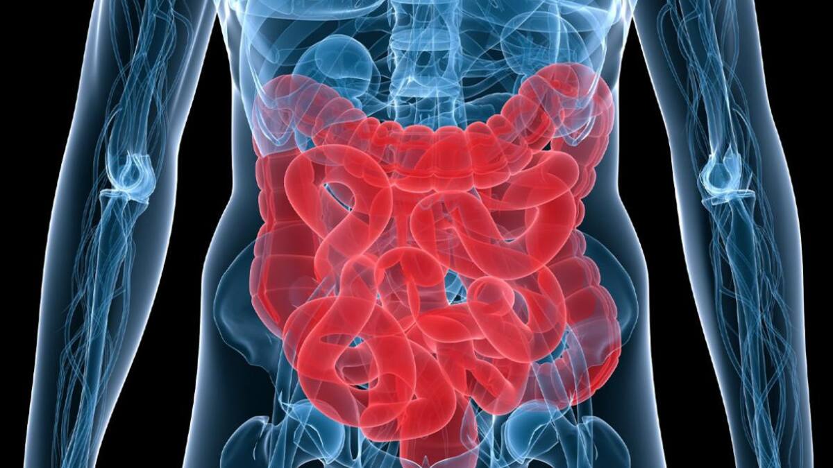 Cáncer de colon, foto IBBiotech