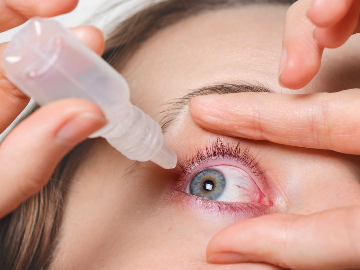 Alerta sanitaria: retiran más de 3 millones de gotas para los ojos por posible riesgo para la salud