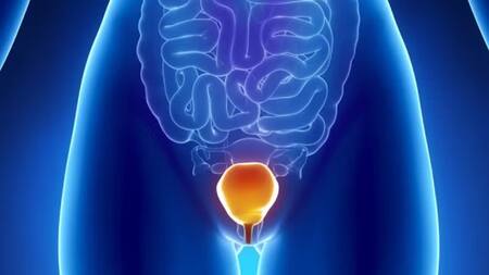 Día Mundial del cáncer de vejiga. Foto: NA.