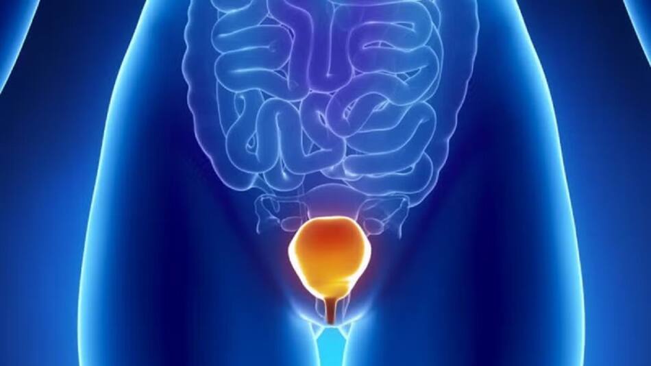 Día Mundial del cáncer de vejiga. Foto: NA.