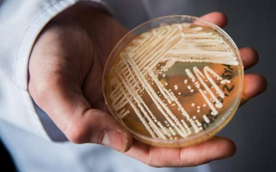 ¿Cuáles son las superbacterias más resistentes? Candida auris