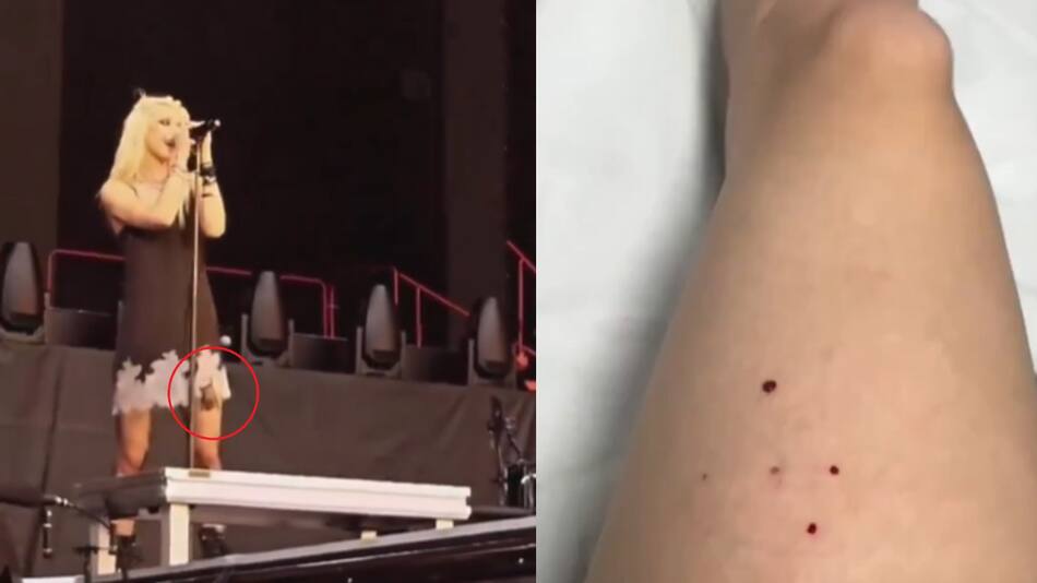 Taylor Momsen fue mordida por un murciélago en pleno show. Fotos: captura video.