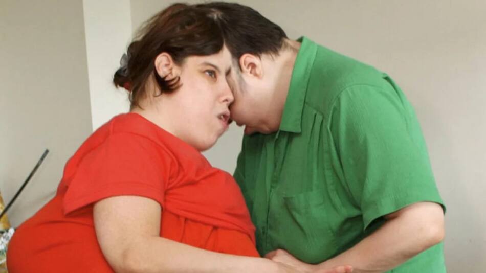 Lori y George Schappell, los gemelos siameses más viejos del mundo. Foto: NA.