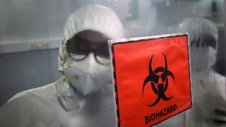 Viruela del Mono, EFE