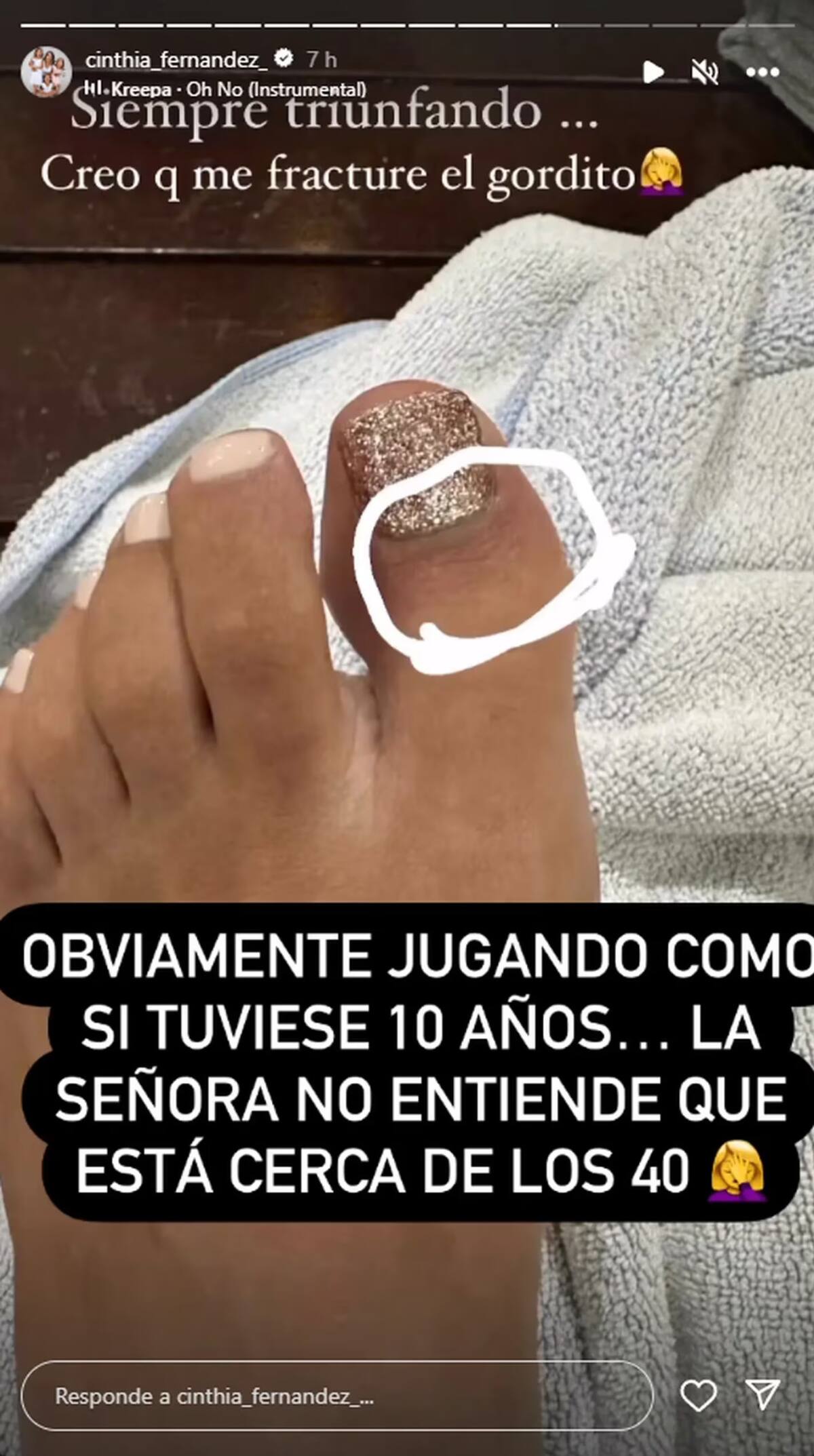 Así quedó el dedo de Cinthia Fernández. Foto: Instagram