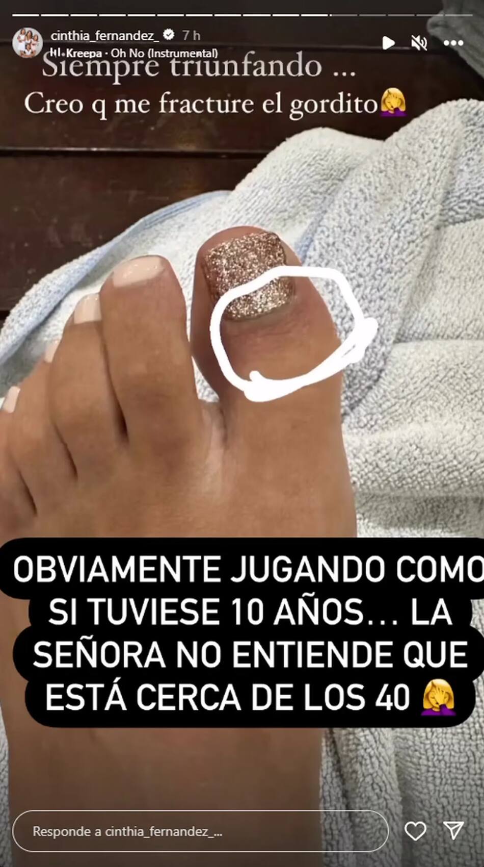 Así quedó el dedo de Cinthia Fernández. Foto: Instagram