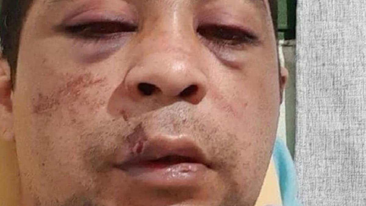 Incendian casa de enfermero con coronavirus: "No queremos gente como vos en el barrio"