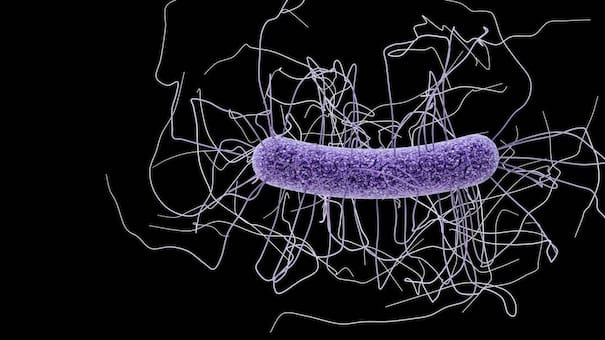 Cáncer de ovarios: según estudio, los microbiomas son indicadores para la detección precoz