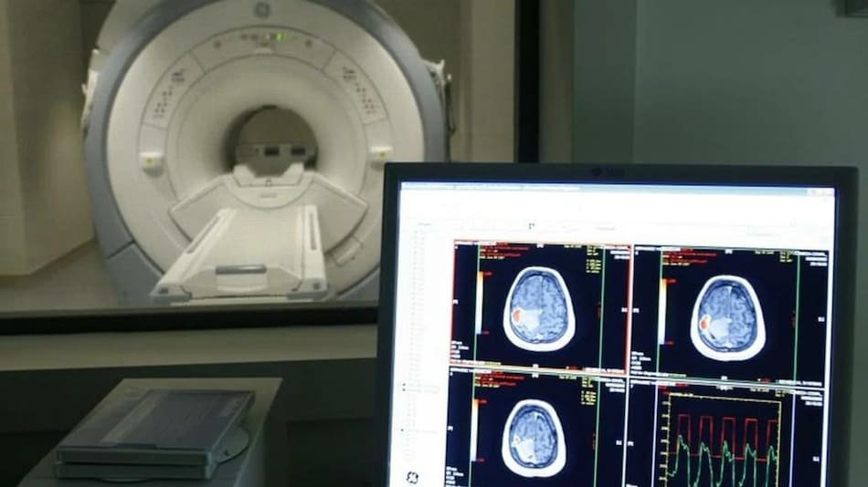 Alzheimer. Foto: REUTERS