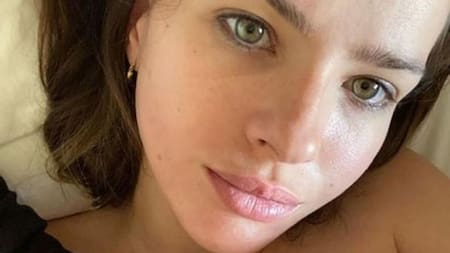 Tras superar el Covid-19, la "China" Suárez reveló que padece cáncer de piel