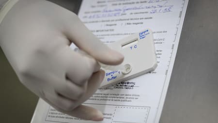 Prueba de COVID-19. Foto: EFE