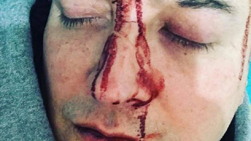 Leo García, cantante, agresión, foto Instagram