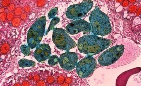 Parásito que ingresa al ser humano a través de gatos