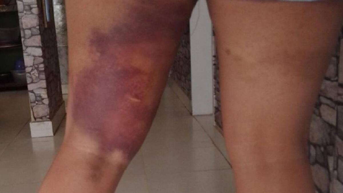 Dos mujeres chocaron, discutieron y una atropelló a la otra, NA