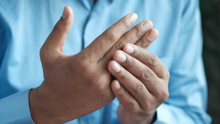 Artritis. Foto: Unsplash