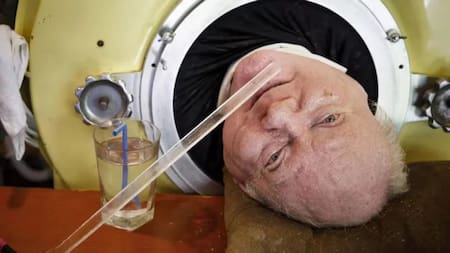 Paul Alexander, hombro que vivió 70 años con un pulmón de acero. Foto: NA.