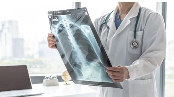 Pre-EPOC: quiénes y a qué edad deben controlarse para evitar la Enfermedad Pulmonar Obstructiva Crónica