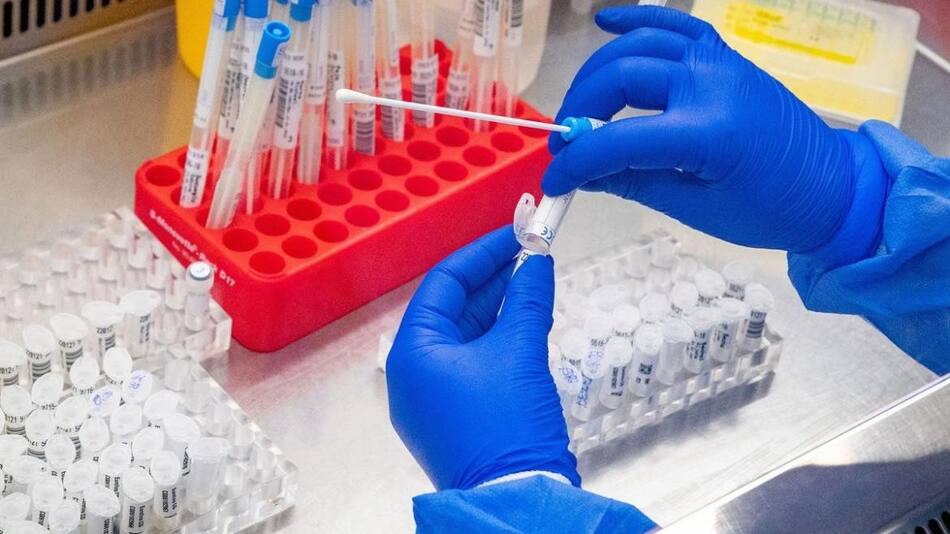 Viruela del mono, enfermedad. Foto: EFE.