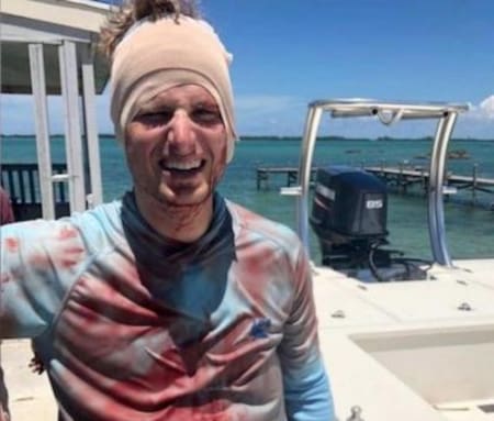 Un tiburón muerde en la cabeza a un buceador