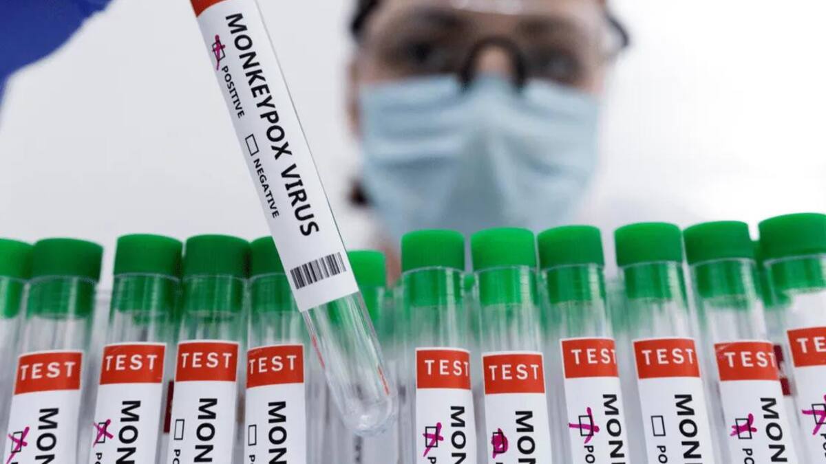 Vacuna contra viruela del mono. Foto: Reuters.