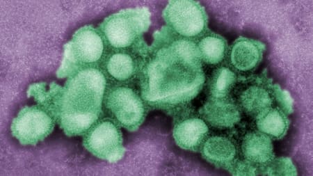 Gripe; microbio; enfermedad. Foto: Unsplash.