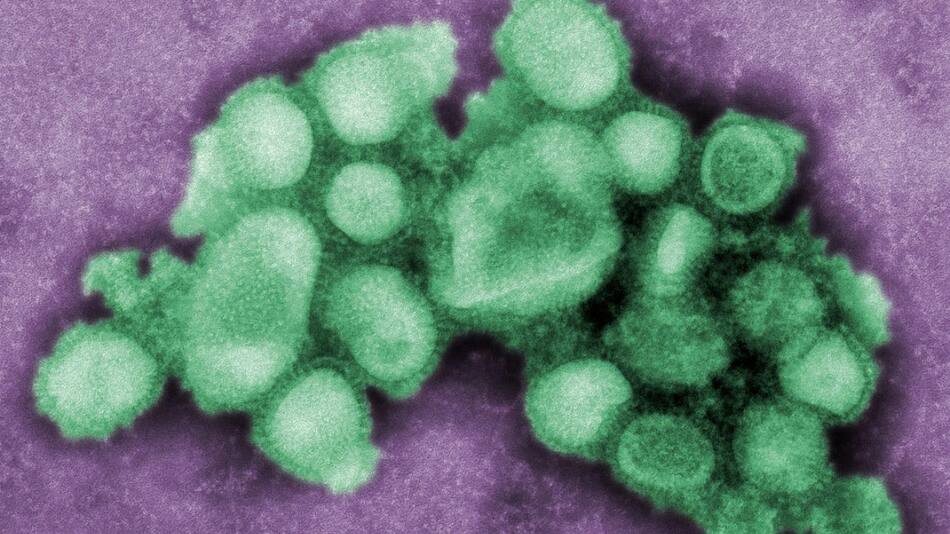 Gripe; microbio; enfermedad. Foto: Unsplash.