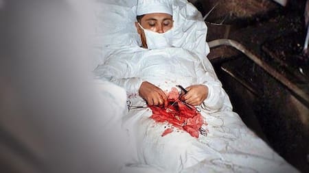Leonid Rógozov, el médico cirujano que se operó a sí mismo