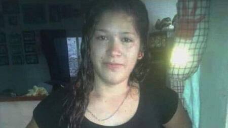 Jennifer Ibarra, joven con hipoacusia encontrada