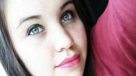 Micaela Cancelo, joven que sufrió quemaduras en 80% de su cuerpo