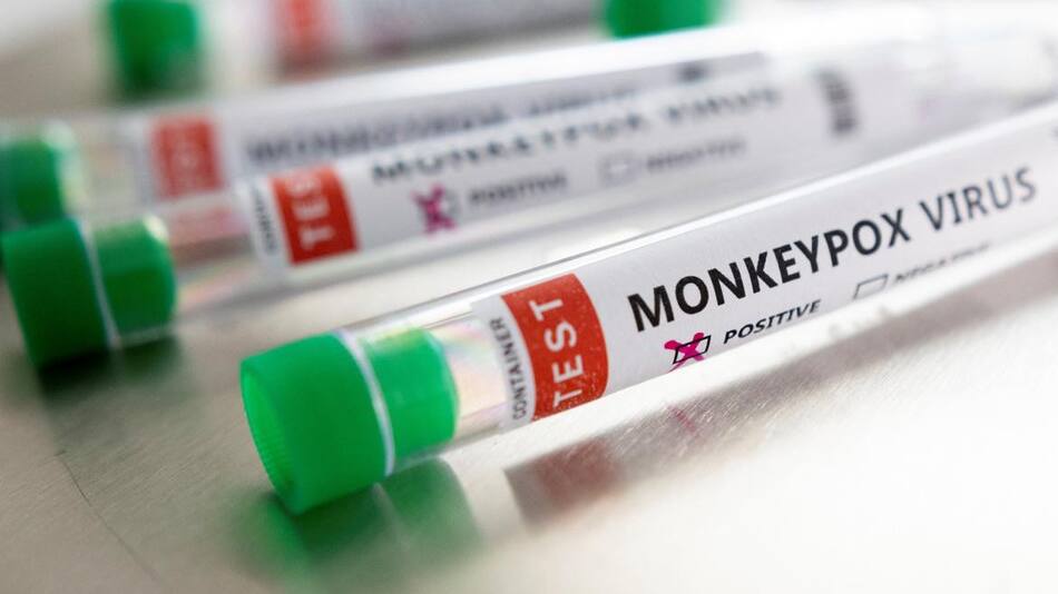 Test contra viruela del mono, Foto Reuters