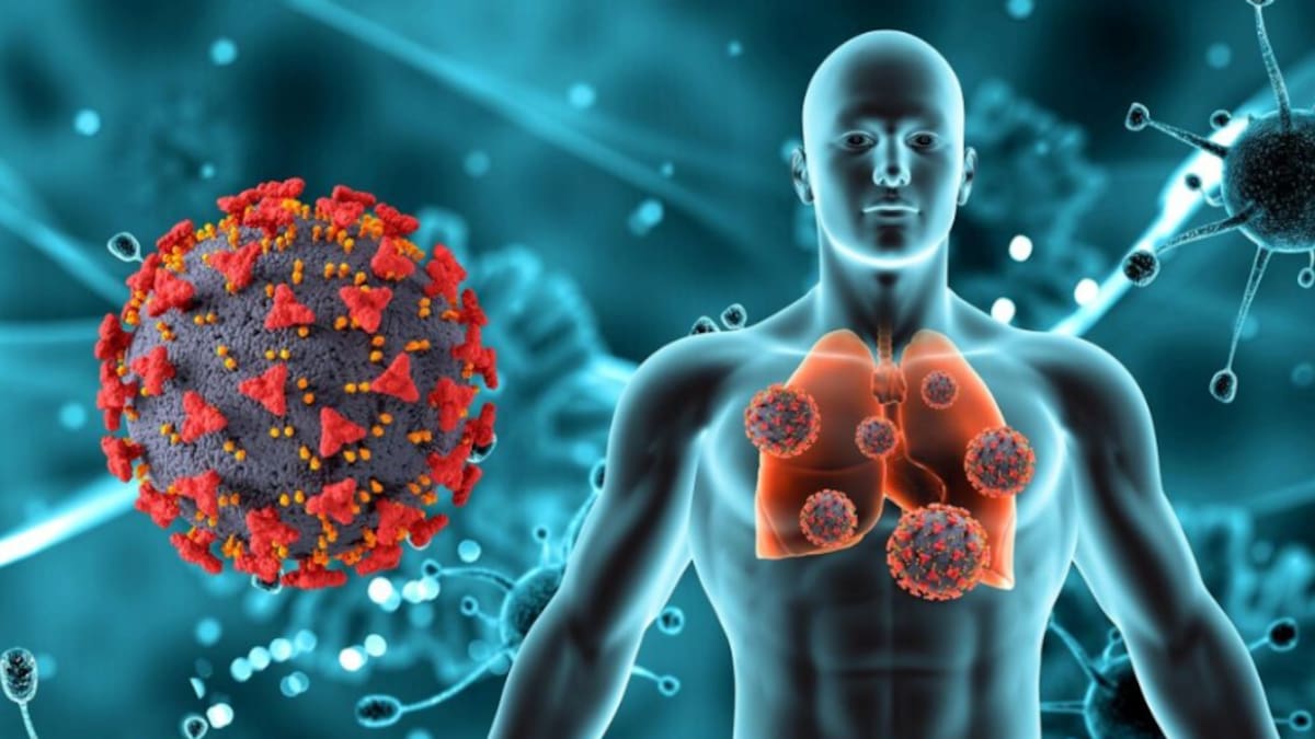 Neumonóloga opina sobre el aumento de casos del Virus Sincicial Respiratorio